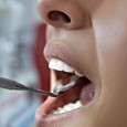 Если пародонтоз запустить, то велика вероятность полного разрушения костной ткани челюсти именно в месте крепления зубов.
